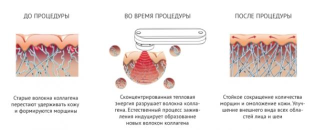 Συσκευή φροντίδας δέρματος M100 μικρορεύματος.  Ο μασάζ προσώπου Gezatone είναι κοσμετολόγος στο σπίτι σε προσιτή τιμή.  Μικρορεύματα – ένα ισχυρό πλήγμα στις αλλαγές του δέρματος που σχετίζονται με την ηλικία