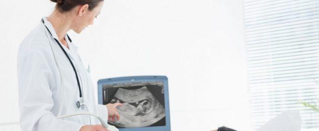 Сколько раз можно делать УЗИ диагностику при беременности, не вредно ли частое исследование на ранних сроках для плода? Опасно ли УЗИ при беременности: влияние разных видов ультразвукового исследования на плод