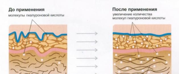 От растяжек во время беременности. Кремы от растяжек для беременных. Какой лучше, рейтинг эффективных средств и отзывы. Крем Mangosteen от растяжек