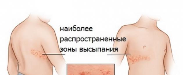 Что делать, если появились шершавые пятна на коже? Красные шелушащиеся пятна, основные причины появления